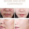 Bonseor Purifying Exfoliating Gel -,Cream, Face and Body Exfoliating Scrub Gel for All Skin (3 PCS) view 3