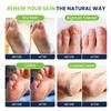 Tea Tree Foot Soak, Callus Remover Gel - Extra Strength Callus Remover Gel & Foot Soak With Epsom Salts For Calluses & Tea Tree Oil Foot Balm/ Moisturizer For Dry Cracked Feet view 3