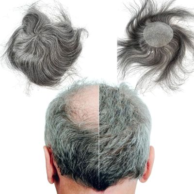 Voloria Bald Spot Hair Patch Toupee for Men 3.15x3.15inches Full PU Skin Base Cover-up Hair Patches Pieces Human Hair Topper Reaplcement Systems Hairpiece (1B Black Mixed 60% Grey Color)