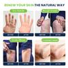 Citrus Detox Foot Soak with Epsom Salts - for Foot Callus, Tea Tree Oil Foot Cream - Moisturizing Athletes Foot Care For Dry Cracked Feet Cream - Heel & Callus Removal view 4