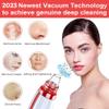 Newest Blackhead Remover Pore Vacuum,Upgraded Facial Pore Cleaner,Electric Acne Comedone Whitehead Extractor Tool-5 Suction Power,5 Probes,USB Rechargeable Blackhead Vacuum Kit for Women & Men view 2
