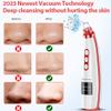 Newest Blackhead Remover Pore Vacuum,Upgraded Facial Pore Cleaner,Electric Acne Comedone Whitehead Extractor Tool-5 Suction Power,5 Probes,USB Rechargeable Blackhead Vacuum Kit for Women & Men view 4