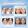 YOYORY Under Eye Patches Masks - for Dark Circles, Puffy Eyes, Fine Lines, Wrinkles, Eye Bags Treatment with Collagen and Hyaluronic Acid, Moisturizing and Hydrating (60 Pcs) view 2