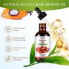 100% Pure & Natural Batana Oil for Hair Growth Eliminates Split Ends Enhances Hair & Skin Shine Nourishes Hair and Is Suitable for Women And Men of All Hair Types view 3