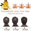 Collagen Hair Treatment Hair Mask & Hair Growth Serum,Deep Conditioner Hydrating Hair Mask for Dry Damaged Hair,Hair Growth Oil for Hair Loss,Natural Hair Regrowth Treatment for Men and Women view 4
