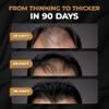 SPARTAN Root Activator Shampoo For Men - Hair Growth Shampoo for Hair Loss and Thinning Hair view 2