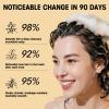 CNMOFAXIN Anti Hair Loss Shampoo,Nourishing Hair Growth Ginger Shampoo for Men & Women - Volumizing Hair Regrowth Treatment infused with Herbal Essences Rose & Castor Oil 16.8 fl. oz view 3