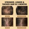 CNMOFAXIN Anti Hair Loss Shampoo,Nourishing Hair Growth Ginger Shampoo for Men & Women - Volumizing Hair Regrowth Treatment infused with Herbal Essences Rose & Castor Oil 16.8 fl. oz view 4