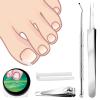 Jeffdad Ingrown Toenail Treatment Kit, 60 Pcs Ingrown Toenail Corrector Strips with Ingrown Toenail Lifter And Nail Clipper, Easy Use Ingrown Toenail Removal Tools view 1