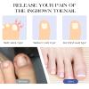Jeffdad Ingrown Toenail Treatment Kit, 60 Pcs Ingrown Toenail Corrector Strips with Ingrown Toenail Lifter And Nail Clipper, Easy Use Ingrown Toenail Removal Tools view 3