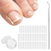 (50+1) Pcs Ingrown Toenail Corrector Treatment Set, Professional Pain-Free Ingrown Toenail Removal Kit with Toenail Lifter, Easy Fixed Ingrown Toenail Tool, Toenail Straightener Strip for Men Women view 1