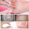 (50+1) Pcs Ingrown Toenail Corrector Treatment Set, Professional Pain-Free Ingrown Toenail Removal Kit with Toenail Lifter, Easy Fixed Ingrown Toenail Tool, Toenail Straightener Strip for Men Women view 3