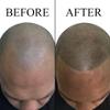 Nuva Scalp Micro-Pigmentation Ink - Customizable, Neutral Undertone for SMP Procedures, Vegan, Made in USA (Red Head) view 4