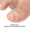 10 Pcs Ingrown Toenail Correction Strips Brace Kit, Ingrown Toenail Corrector Straightener Strips Recover Clips Toenails Thick Pedicure Tool Toenail Straightener Strip for Men Women Foot Care Tool Gr view 4