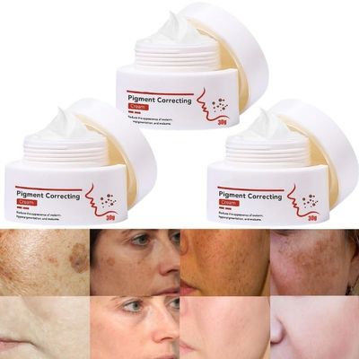 1/2/3pcs Cremas Para Las Manchas de La Cara, 30ml Cremas para Manchas de La Cara, crema para manchas de la piel, Cremas para Las Manchas de La Cara Oscuras (3pcs)