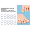 10PCS Toenail Corrector,Washable Reusable Silicone Ingrown Toenail Correcting Tool for Foot Care view 2