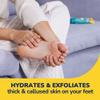 Dr Scholl's Dry, Flaky Skin Remover Ultra Exfoliating Foot Lotion with Urea for Rough Dry Cracked Feet, Heal and Moisturize for Healthy Looking Feet, Intensive Foot Care, Alpha Hydroxy Acids, 3.5 oz view 4