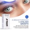 Zocular ZocuLash Eyelash Serum - Safe, Effective Eyelash Growth Serum for Daily Use - 2.5 mL view 2