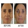 Dr.Sevinor Skincare Solutions Dr Sevinor Combo Genuine Face Lift Solution 4oz. and Wrinkle Smoothing Solution Tinted Serum 1 Fl. Oz. 2-Pack Special Save 10% Feel the Confidence! Sold by Dr.Sevinor view 2