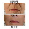 Dr.Sevinor Skincare Solutions Dr Sevinor Combo Genuine Face Lift Solution 4oz. and Wrinkle Smoothing Solution Tinted Serum 1 Fl. Oz. 2-Pack Special Save 10% Feel the Confidence! Sold by Dr.Sevinor view 3