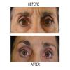 Dr.Sevinor Skincare Solutions Dr Sevinor Combo Genuine Face Lift Solution 4oz. and Wrinkle Smoothing Solution Tinted Serum 1 Fl. Oz. 2-Pack Special Save 10% Feel the Confidence! Sold by Dr.Sevinor view 4