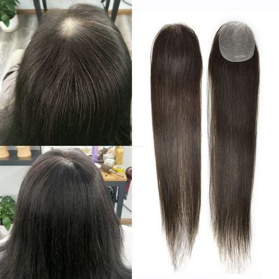 Ultra Thin Skin Bald Spot Hair Patch Non Surgical Human Hair Replacement Unit Toupee for Men Women V-Looped Hairpiece Hair Toppers Black Brown Men Toupee16"#4 Medium Brown-100% density