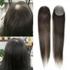 Ultra Thin Skin Bald Spot Hair Patch Non Surgical Human Hair Replacement Unit Toupee for Men Women V-Looped Hairpiece Hair Toppers Black Brown Men Toupee16"#4 Medium Brown-100% density view 1