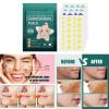 hejhncii Invisible Pimple Patches Stickers Pimple Remover Tool Hydrocolloid Face Patches Skin Care Waterproof Pimple Patches Treatments Blemish Patches Zit Patches view 2