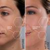 Michael Todd Beauty - Sonicsmooth Pro+ Dermaplaning Blade Refills - 8 Dermaplaning Blades- 2 Month Supply - Device Not Included view 3