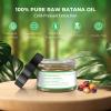 Mysense Raw Batana Oil, 100% Pure Unrefined and Organic Growth Oil from Honduras, Scalp Care for Women & Men, Prevent Hair Loss, Promote Hair Thickness view 2