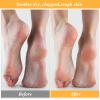 5 Pairs Foot Moisturizer Socks, Moisturizing Socks Overnight, Cotton Spa Socks for Cracked Heel Repair, Gel Spa Moisturizing Socks for Women and Men, White view 3