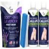 Soothing Lavender Foot Soak with Epsom Salt - Best Toenail Treatment, & Softens Calluses - Soothes Sore & Tired Feet, Callus Remover for Feet with Extra Strength Gel & Foot Pumice Stone Set view 1