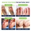 Foot Soak with Epsom Salts- Variety Pack of 4- Tea Tree Oil, Muscle Relief, Calming Lavender & Citrus Soak Callus Remover for Feet with Extra Strength Gel & Foot Pumice Stone Set view 2