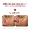 EltaMD UV Clear Tinted Face Sunscreen, SPF 46 Oil- Free with Zinc Oxide, Dermatologist Recommended, Stocking Stuffer view 4
