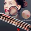 Aurgiarme 4Pcs/Set Rose Stainless Steel Blackhead Remover Pimple Comedone Double For Head Extractor Cleansing Tools Kit Pimple Comedone Extractor view 3