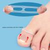 FILFEEL 10 Pcs Ingrown Toenail Corrector Ring, Silicone Ingrown Toe Correcting Nail Correct Brace Ring - Stretch Resistant, Reusable view 3