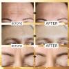 Jakuva 24K Gold Forehead Wrinkle Patches for Face-Hydrogel Pads with Hydrolyzed Collagen And Vitamin E, Forehead Wrinkles Care for Strips Moisturizing,20PCS view 4