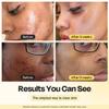Gleamin Vitamin C Clay Mask for Dark Spots, Turmeric Clay Face Mask Skin Care, Deeply Cleanses & Refines Pores, Brightens Uneven Tone and Helps Improve Post-Blemish Scarring & Texture - 5 Oz view 2