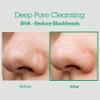 BLITHE AHA BHA Cleanser - Deep Pore Cleanser and Pore Minimizer, Exfoliant for Face, For Clogged Pores, 5.07 Fl Oz view 3
