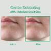 BLITHE AHA BHA Cleanser - Deep Pore Cleanser and Pore Minimizer, Exfoliant for Face, For Clogged Pores, 5.07 Fl Oz view 4