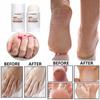 fenlebeneil Urea Cream 40 Percent for Foot and Dry Cracked Heel 40% Urea Feet Cream Balm Stick for Foot Hand Moisturizing Feet Hand Care Balm For Women Men 1.06Oz view 3