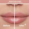 Facial Hair Removal for Women, Portable Lady Shaver, Rechargeable Painless Hair Remover for Face, Upper Lips, Chin, Peach Fuzz view 3