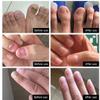Nail Treatment,1PC Nail Treatment Nail Renewal Solution Toenails & Fingernails Nail Repairs Essential Oil Protects From Discoloration, Brittle And Cracked Nail(12ML) view 3