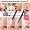 2pcs Replaceable Metal Head for Blackhead Remover, Supports WiFi Blackhead Removal view 3