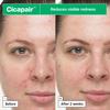 Dr.Jart+ Cicapair So Soothing Face Treatment Korean Gel Cream for Visibly Irritated Skin with Centella Asiatica | Korean Skin Care, 1.01 Fl Oz view 3