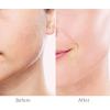 Generation 3 Replacement Heads for Finishing Touch Flawless Facial Hair Remover, Double Precision Replacement Blades Heads Compatible with New Flawless Gen 3, 6 pack view 3