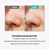 SLLIGHT Centella Poreless Patches (1 Box, 8ea) | Hydrocolloid Nose Pore Patch for Blackhead Removal | Calming Facial Patch with Centella Asiatica for Nose Area | Sebum Control | Korean Skincare view 4