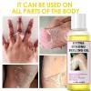 NinthAvenue Basics Extra Strong Yellow Peeling Oil for Dark Skin, Exfoliating Solution for Body, Hand, Feet and Face - All Skin Types (330ML/11.7 Fl Oz) view 4