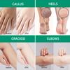 Urea Cream 40 Percent for Feet Maximum Strength - Fast Absorption, No Strong Odor. Foot Cream for Dry Cracked Heels and Feet, Gentle Exfoliating Moisturizing, Suitable for Foot, Hands and Knees view 3