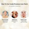 GENDA Pimple Patches for face, Acne Spot Patches for Zits and Blemish Dots, Hydrocolloid Invisible Spot Stickers - 36 Count. view 3
